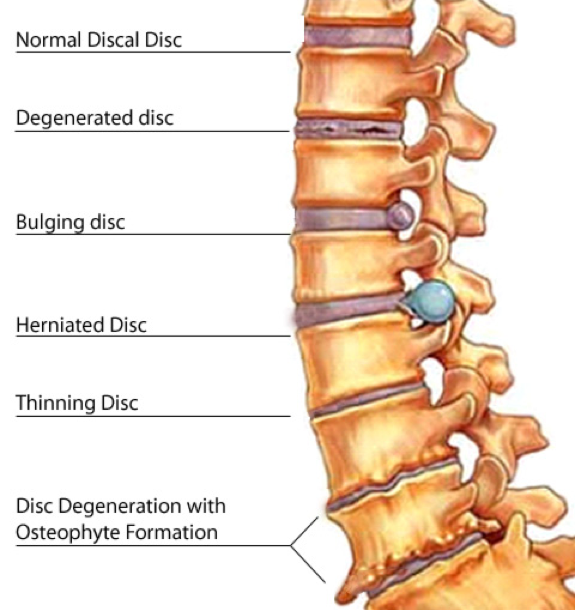 Post-Rehabilitation Pilates Essentials - London College of Osteopathy and  Health Sciences